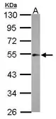 Anti-ILK antibody [N1C1-2] used in Western Blot (WB). GTX107443