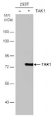 Anti-TAK1 antibody used in Western Blot (WB). GTX107452