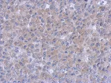 Anti-Syk antibody [N1C1] used in IHC (Paraffin sections) (IHC-P). GTX107459