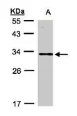 Anti-DAPP1 antibody [N1C3-2] used in Western Blot (WB). GTX107466