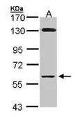 Anti-Glycerol kinase antibody [N1N3-2] used in Western Blot (WB). GTX107474