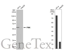 Anti-PNK antibody [N1C1] used in Western Blot (WB). GTX107488