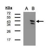 Anti-CaMKI delta antibody [N1C1] used in Western Blot (WB). GTX107490