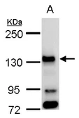 Anti-BUB1 antibody used in Western Blot (WB). GTX107497