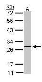 Anti-GK5 antibody used in Western Blot (WB). GTX107498