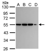 Anti-CaMKI gamma antibody used in Western Blot (WB). GTX107499