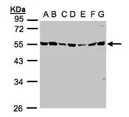 Anti-MST3 antibody [N1C1] used in Western Blot (WB). GTX107500