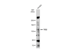 Anti-TIE2 antibody used in Western Blot (WB). GTX107505