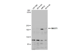 Anti-MAST1 antibody [N2N3] used in Western Blot (WB). GTX107508