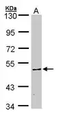 Anti-CaMKIV antibody used in Western Blot (WB). GTX107515