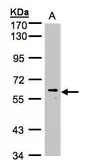 Anti-MAPK15 antibody used in Western Blot (WB). GTX107519