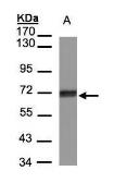 Anti-CCDC6 antibody used in Western Blot (WB). GTX107522