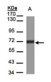 Anti-CCDC6 antibody used in Western Blot (WB). GTX107522