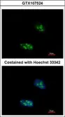 Anti-EXOSC10 antibody used in Immunocytochemistry/ Immunofluorescence (ICC/IF). GTX107524