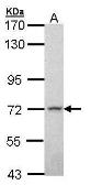 Anti-MPP2 antibody [N1C1] used in Western Blot (WB). GTX107528