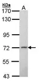 Anti-MPP2 antibody [N1C1] used in Western Blot (WB). GTX107528