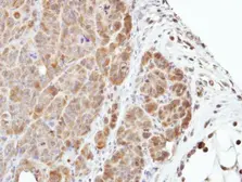 Anti-MEK3 antibody [N1C3] used in IHC (Paraffin sections) (IHC-P). GTX107529