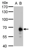 Anti-Pyruvate Kinase (liver/RBC) antibody used in Western Blot (WB). GTX107546