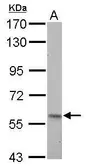Anti-Pyruvate Kinase (liver/RBC) antibody used in Western Blot (WB). GTX107546