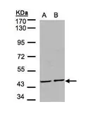 Anti-YANK2 antibody [N1C1-2] used in Western Blot (WB). GTX107555