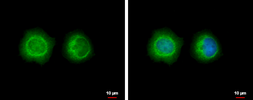 Anti-LYK5 antibody used in Immunocytochemistry/ Immunofluorescence (ICC/IF). GTX107557