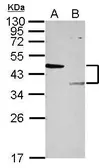 Anti-LYK5 antibody used in Western Blot (WB). GTX107557