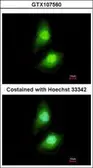 Anti-SKAP55 antibody [N1C3-2] used in Immunocytochemistry/ Immunofluorescence (ICC/IF). GTX107560