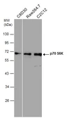 Anti-p70 S6K antibody used in Western Blot (WB). GTX107562