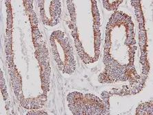 Anti-Glycerol kinase 2 antibody [N1C1-3] used in IHC (Paraffin sections) (IHC-P). GTX107563