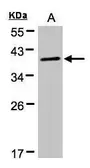 Anti-PKA C alpha antibody used in Western Blot (WB). GTX107567