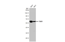 Anti-TAB1 antibody used in Western Blot (WB). GTX107571