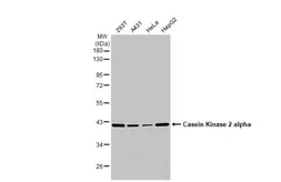 Anti-Casein Kinase 2 alpha antibody used in Western Blot (WB). GTX107576