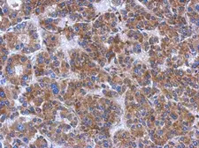 Anti-FN3K antibody [N1C3-2] used in IHC (Paraffin sections) (IHC-P). GTX107579