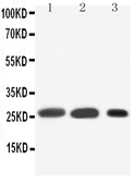 Anti-Surfactant Protein A antibody used in Western Blot (WB). GTX10761