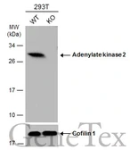 Anti-Adenylate kinase 2 antibody [N1C3] used in Western Blot (WB). GTX107613