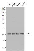 Anti-PGK1 antibody used in Western Blot (WB). GTX107614