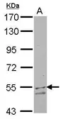 Anti-UGP2 antibody [N1C1-2] used in Western Blot (WB). GTX107616