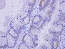 Anti-COASY antibody used in IHC (Paraffin sections) (IHC-P). GTX107623