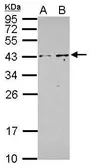 Anti-PIP5KL1 antibody used in Western Blot (WB). GTX107627