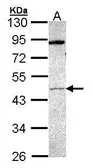 Anti-PRAK antibody used in Western Blot (WB). GTX107628