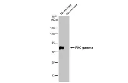 Anti-PKC gamma antibody used in Western Blot (WB). GTX107639