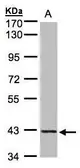 Anti-PRPSAP2 antibody [N1C3] used in Western Blot (WB). GTX107648