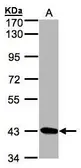 Anti-DRAK1 antibody [N1C1-2] used in Western Blot (WB). GTX107669