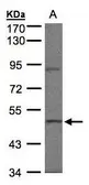 Anti-Brk antibody [N1C1] used in Western Blot (WB). GTX107671