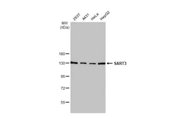 Anti-SART3 antibody [C3], C-term used in Western Blot (WB). GTX107684