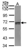 Anti-PRPF31 antibody [C3], C-term used in Western Blot (WB). GTX107696