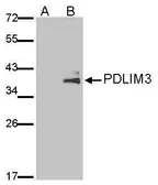 Anti-ALP / PDLIM3 antibody [C2C3], C-term used in Western Blot (WB). GTX107697