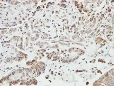 Anti-SHANK1 antibody [C3], C-term used in IHC (Paraffin sections) (IHC-P). GTX107701