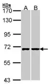 Anti-RIC8A antibody used in Western Blot (WB). GTX107712