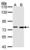 Anti-Rabenosyn 5 antibody [C3], C-term used in Western Blot (WB). GTX107713